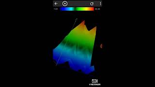 Android Gradiometer Using [upl. by Ecnedac]