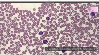 What blood looks like down the microscope [upl. by Isabella999]