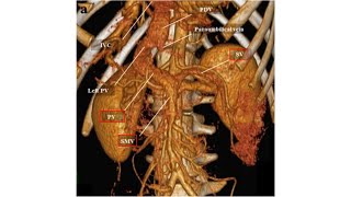 PORTAL HEPATIC SYSTEM [upl. by Riggins133]