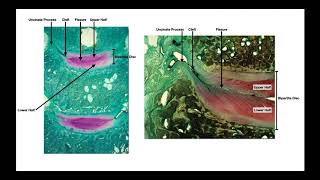 Uncovertebral Joints amp the Bipartite Disc  Developmental Timeline [upl. by Einahpehs]