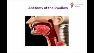 Stroke Education  Dysphagia [upl. by Allicserp874]