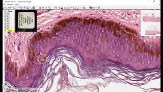 Keratinized stratified squamous epithelium [upl. by Atiragram]