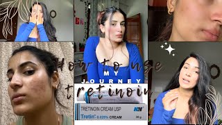 How to use tretinoin 0025 my journeyE2 tretinoin tretinoincream myjourney acnetreatment [upl. by Aekan]