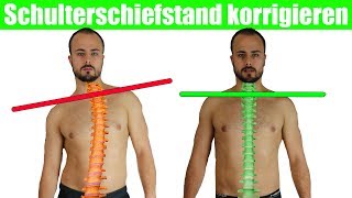 Schulterschiefstand beheben  Krumme Wirbelsäule  Brustkorb aufrichten [upl. by Enoitna]