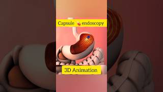 capsule 💊endoscopy 3d Animation capsulecapsule endoscopy capsulecorp 3danimation healtheducation [upl. by Aggappe]