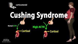 Cushing Syndrome Animation [upl. by Aikcir576]