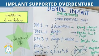 learn implant overdenture [upl. by Cheryl]