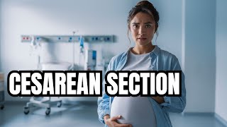 What You NEED To Know About CSections [upl. by Allyson]