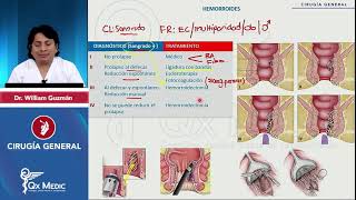 CX GENERAL  PATOLOGÍA ANORRECTAL  2024 QX MEDIC [upl. by Eeldivad]