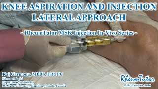 KNEE ASPIRATION  INJECTION LATERAL APPROACH  InVivo Series [upl. by Adnahcal]