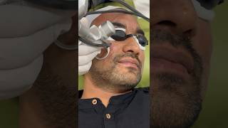 Best Laser treatment for your face [upl. by Stephan]