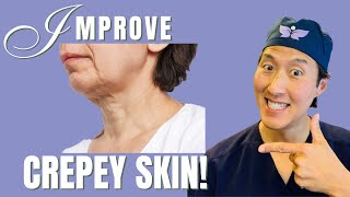 How To Improve Crepey Skin Holistically [upl. by Som838]