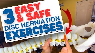 3 EASY amp SAFE L5S1 Disc Herniation Exercises amp L4L5  Dr Marc Dupuis Chiropractor in Sanford ME [upl. by Neelrahc]