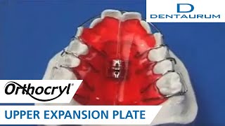 Orthocryl®  fabricating an upper expansion plate orthodontic appliance [upl. by Trillby]