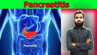 Pancreatitis  causes symptoms diagnosis treatment pathology  lecture In Urdu amp Hindi [upl. by Xonel929]