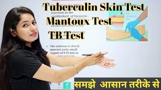 Tuberculin Skin Test  Mantoux Test  Mantoux Test in hindi  TB Test [upl. by Orton]