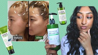 Ayurvedic Treatment for Hair Problems [upl. by Macilroy12]