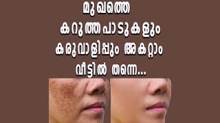 How to remove black spots and melasmakarimangalyam from face and its cause [upl. by Aihsi]