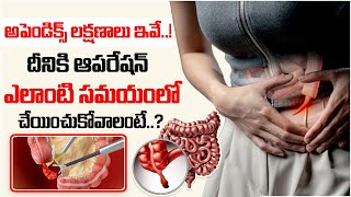 Symptoms of Appendicitis  Laparoscopic Appendectomy Surgery  ManamtvDoctorsOfficial [upl. by Genia]