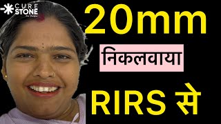 RIRS से निकला Stone in 15 minutes  Laser Kidney Stone Treatment  Patient Feedback  RIRS [upl. by Rockey]