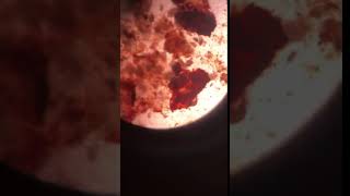 Ear mites  Veterinary Video [upl. by Gonsalve]