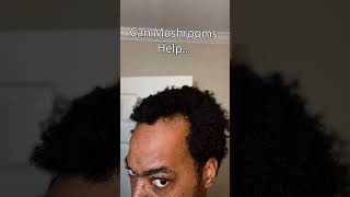 Can Mushrooms Help Grow Your Hairline Back pt 2 [upl. by Tserof]