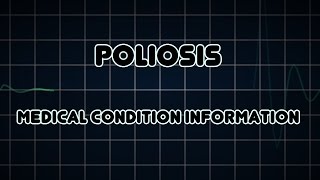 Poliosis Medical Condition [upl. by Inah]