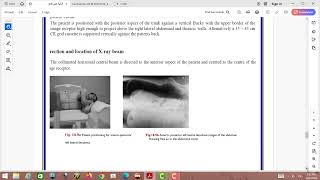 Antero posterior – left lateral decubitus [upl. by Mann]