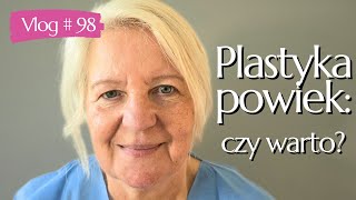 98 PLASTYKA POWIEK GÓRNYCH PRZED I PO moja opinia efekty i czy warto👁️✨ [upl. by Tarah]