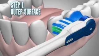 Colgate 360 Battery Operated Toothbrush [upl. by Perreault]