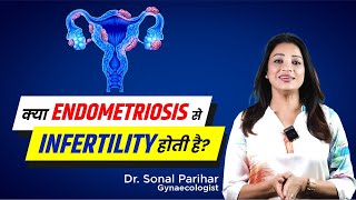 Endometriosis amp Infertility  Medicine ya surgery  Kya better option Hai  Sonal Parihar [upl. by Euqirne]