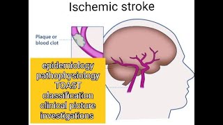 Ischemic stroke symptoms risk factors classification imaging [upl. by Borszcz152]