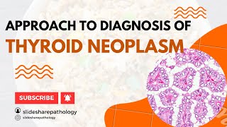 Approach to Thyroid Neoplasms with Case Based Discussion  WHO Classification of Thyroid Neoplasm [upl. by Einnob982]