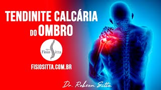 DOR no OMBRO TENDINITE CALCÁRIA CAUSAS e TRATAMENTO de FISIOTERAPIA  Fisioterapia Dr Robson Sitta [upl. by Prudhoe]