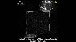 Breast Cancer Cells Building Fibrin Networks [upl. by Ranit]