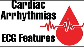 Cardiac Arrhythmiasphysiology part 1  ECGEKG Features  Guyton [upl. by Heman988]