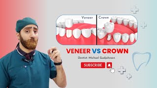 Veneer vs Crown  which is best for teeth  Doctor Gudjohnsen [upl. by Ylus330]