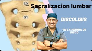 Sacralizacion Lumbosacra y Protrusiones de disco [upl. by Nitsirc]