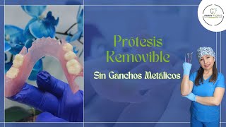 Prótesis removible flexible La mejor alternativa sin ganchos metálicos [upl. by Myrta]