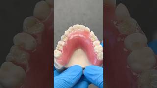 Acrylic Partial EnvisiontecMain envisiontec lsk121shorts dentist [upl. by Deyes]