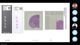 JCS 22 Tumor microenvironment of primary CNS lymphoma [upl. by Cohby]