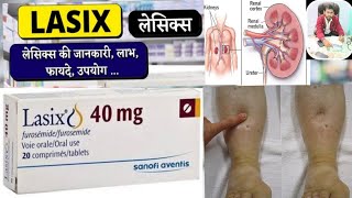 Lasix 40 mg tablet uses in hindi  Lasix Tablet  Furosemide 40 mg [upl. by Miranda934]