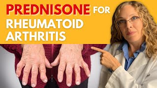 Managing Rheumatoid Arthritis with Prednisone Dosage Effectiveness and Side Effects [upl. by Asira176]