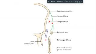 infratemporal fossa anatomy [upl. by Allehcim]