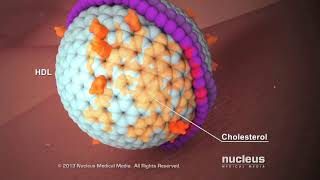 Hyperlipidemia High Cholesterol at Cook Childrens [upl. by Aalst]