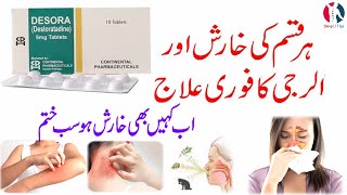 Desora 5mg tablet  Desora 5mg tablet uses in urdu  Desloratadine 5 mg tablets  Desora 5mg  hindi [upl. by Aicaca158]