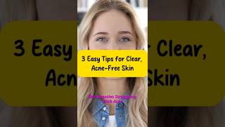 3 Easy Tips for Clear AcneFree Skin [upl. by Raila65]