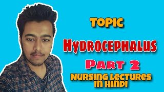 Hydrocephalus Causes Types  Symptoms Treatment  Surgery Nursing Lecture in Hindi Pediatric 2 [upl. by Akahc695]