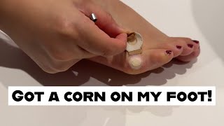 got a corn on a foot [upl. by Evvie898]