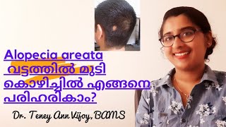 Alopecia areatahair loss malayalamDrTeney [upl. by Yonah]